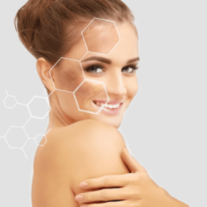 Muita Acne? Como anda seu intestino?